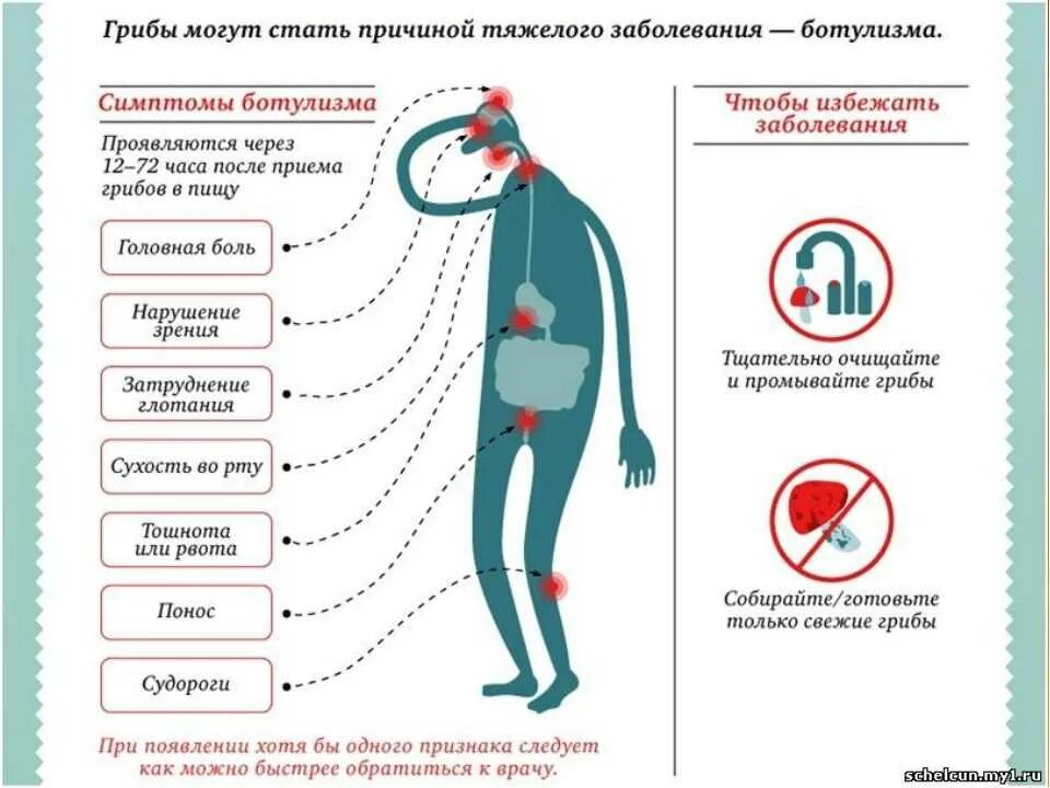 Отравление признаки у взрослых симптомы. Признаки отравления ботулизмом симптомы. 1 признаки отравления. признаки пищевого отравления. пищевое отравление грибами симптомы.