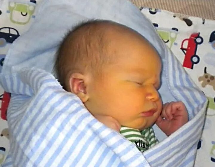 Желтушка в 1 месяц. Норма билирубин новорожденных желтушка у новорожденных. Физиологическая желтушка у новорожденного. Желтушка у новорожденного норма билирубина. Нормы показателей от желтухи у новорожденных.