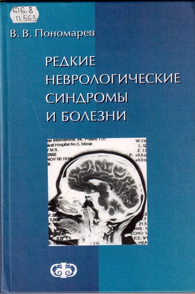 Неврологическое заболевание синдром. Пономарев редкие неврологические синдромы и болезни. Синдромы в неврологии. Редкие заболевания в неврологии книга. Редкие синдромы в неврологии.