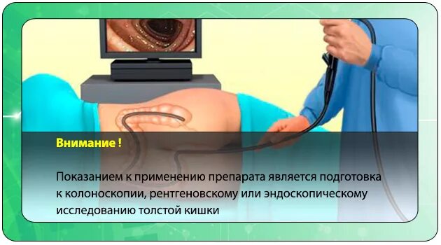 Сколько по времени колоноскопия длится с наркозом. Колоноскопия это метод исследования. эндоскопическое исследование кишечника. аппарат для колоноскопии кишечника. скрининговая колоноскопия.