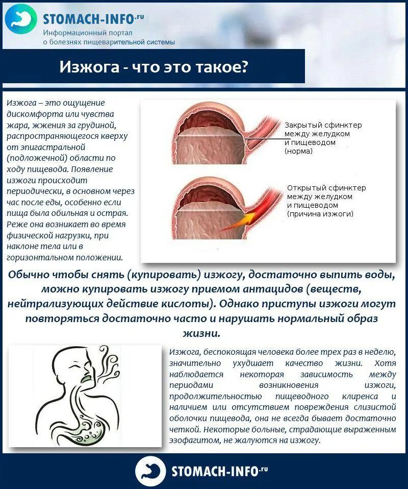 От чего может быть изжога каждый. Изжога причины. причины возникновения изжоги.