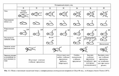 Гипертонус языка это