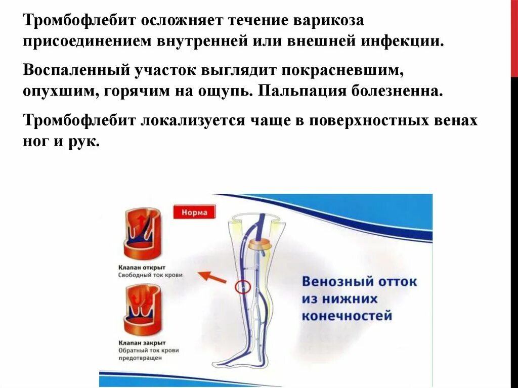 Тромбофлебит карта вызова. Артериальные и венозные тромбозы диагностика. Заболевание периферических артерий и вен.