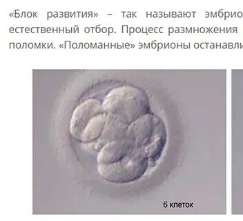 Как выглядят эмбрионы эко