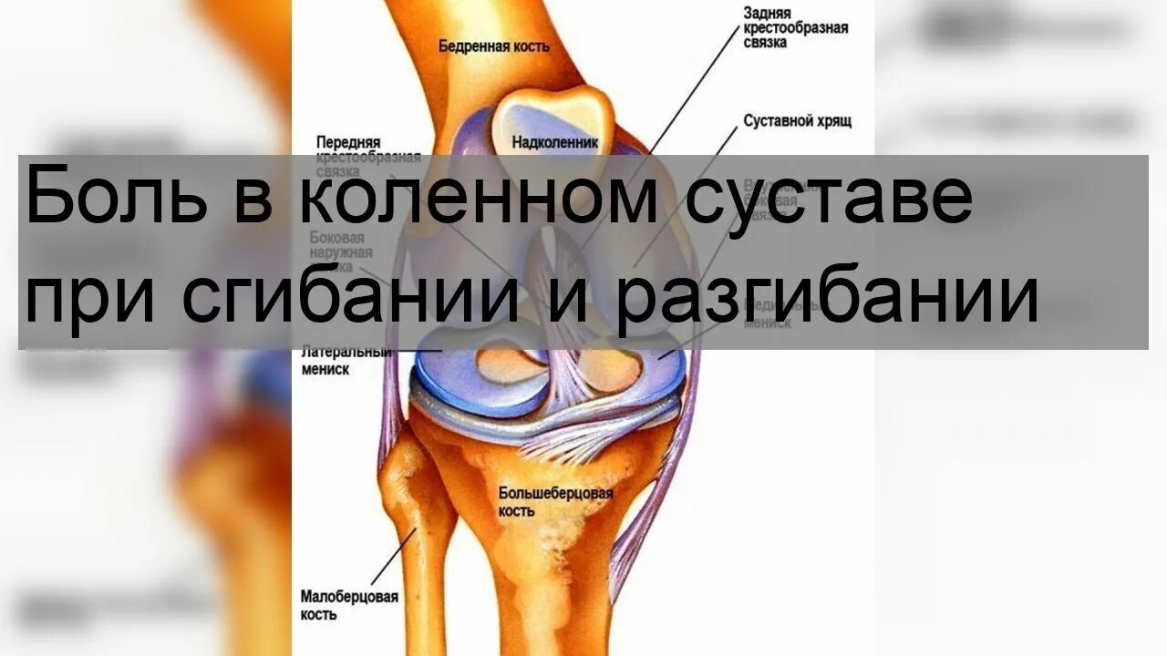 Сильные боли при разгибании колена. Колено болит при сгибании и разгибании. Боль в коленном суставе при сгибании и разгибании причины. Боль в коленном суставе причины. Жидкость в коленном суставе.