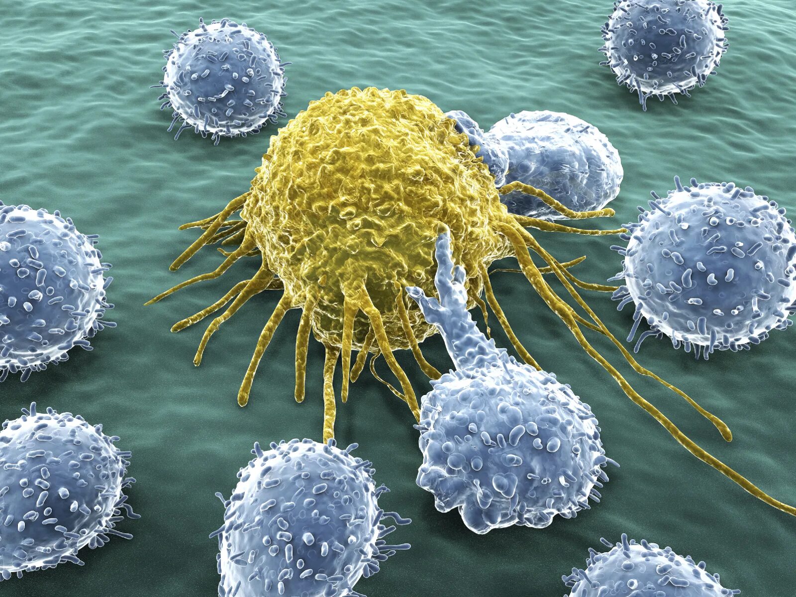 Т-лимфоциты иммунной системы. Раковая клетка и т лимфоцит. Т-лимфоциты микроскопия. Вирусы лейкоциты фагоциты. Клетке и т д в