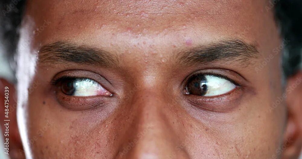 Cf happy eyeballs failure. Cf happy eyeballs failure
