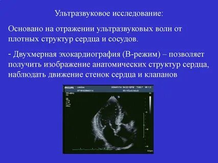 Лучевые методы диагностики узи