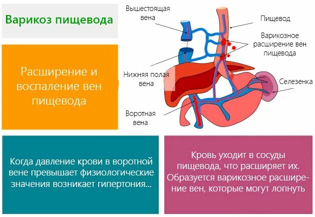 Сосуды пищевода