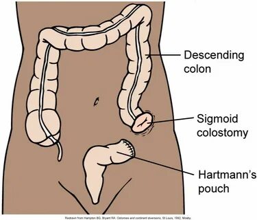 Sigmoid