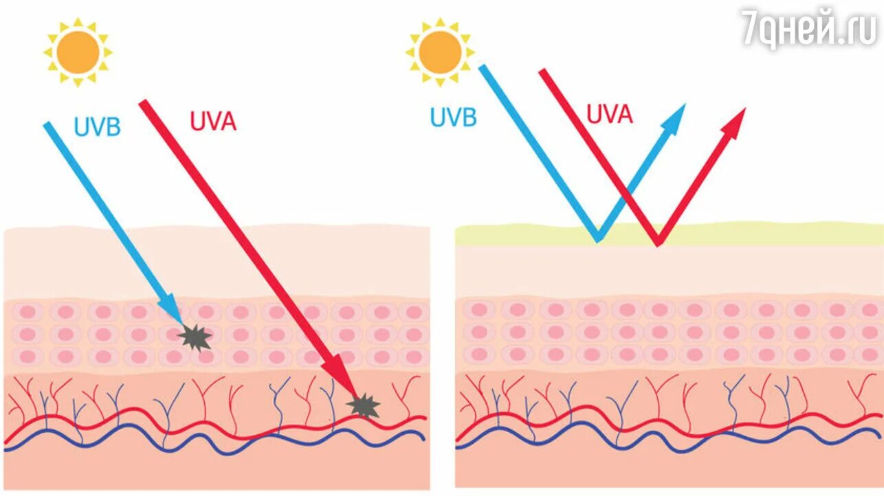 Воздействие УФ излучения на кожу. Воздействие УФ лучей на кожу. Защита от УФ лучей кожа.