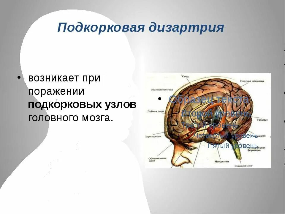 Подкорковые поражения мозга. Подкорковая дизартрия поражение. Подковые узлы головного мозга. Подкорковые структуры головного мозга. Дизартрия возникает при поражении.