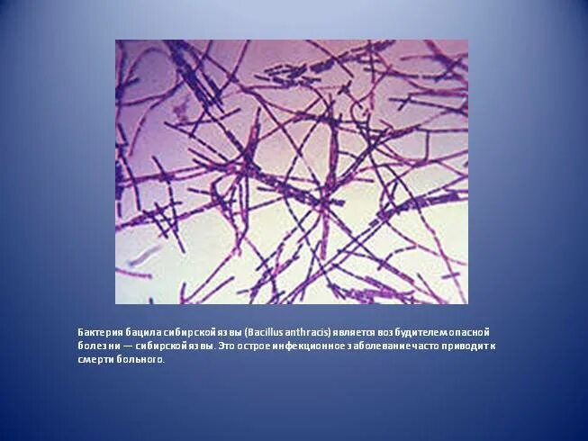 В скотомогильниках бактерии очень опасного заболевания. Бактерии сибирской язвы могут выживать в скотомогильниках. Сибирская язва Сезонность. Сибирская язва симптомы.