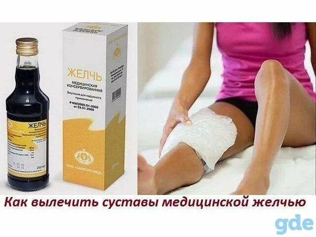 Желчь медицинская консервированная эмульсия 250мл. Пяткашпор крем гель. Медицинская желчь для пяточной шпоры. Лечение шпоры желчью медицинской отзывы. Желчь лекарство для суставов.