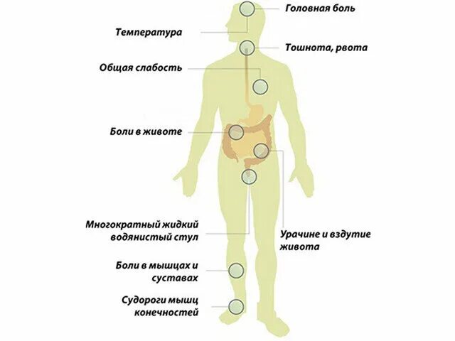 Клинические проявления гастроинтестинальной формы сальмонеллеза. Клиника сальмонеллеза у детей. Сальмонеллез клинические проявления. Больница сальмонеллез