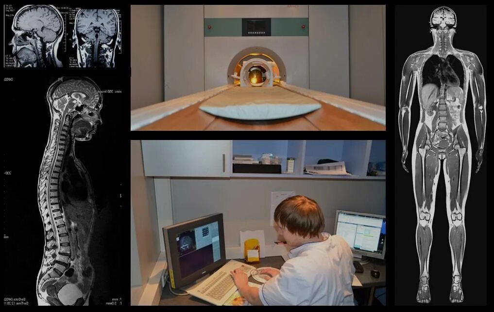 Рентген можно сделать. Магнитно-резонансная томография рентген. Рентген компьютерная томография. Томография тела. Рентген томограф.