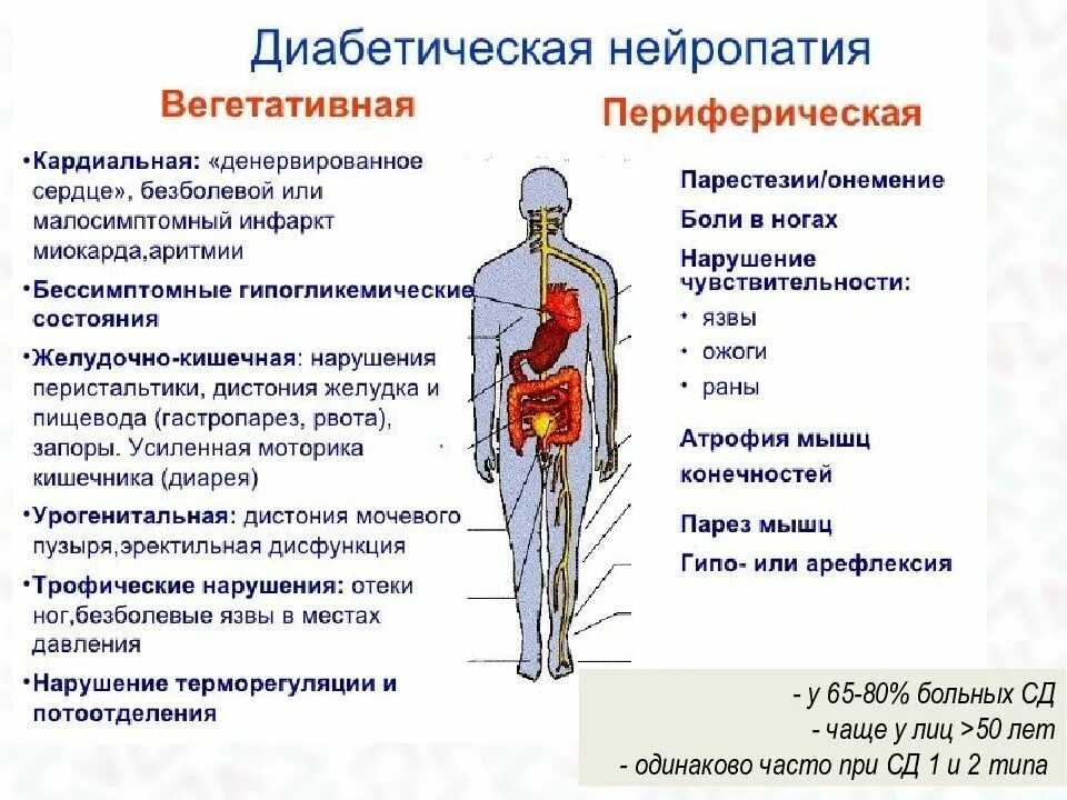 Полинейропатия при сахарном диабете 2 типа. Симптомы диабетической полинейропатии. диабетическая нейропатия симптомы. диабетическая периферическая полинейропатия, сенсомоторная форма. диабетическая нейропатия формы.