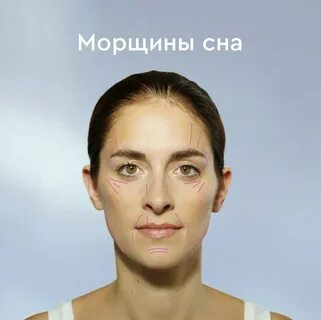 Морщины сна