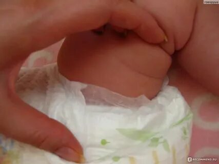 Кездейсоқ секс хроникасын қараңыз