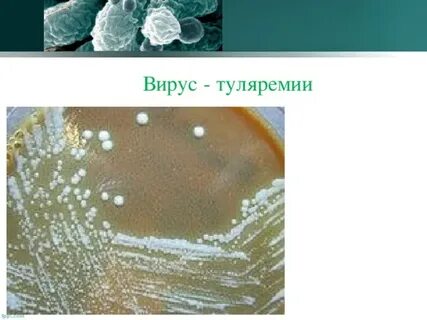 Холера чума и туляремия