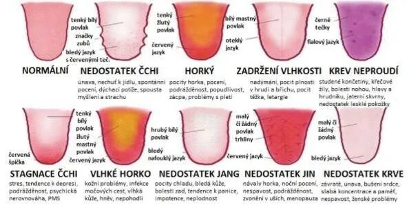 Pojavilsia herpes na jazyk i stalą obilno videliatsia Sliuna. Язык при аппендиците