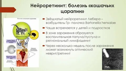 Симптом кошачьей царапины