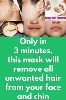 Remove only
