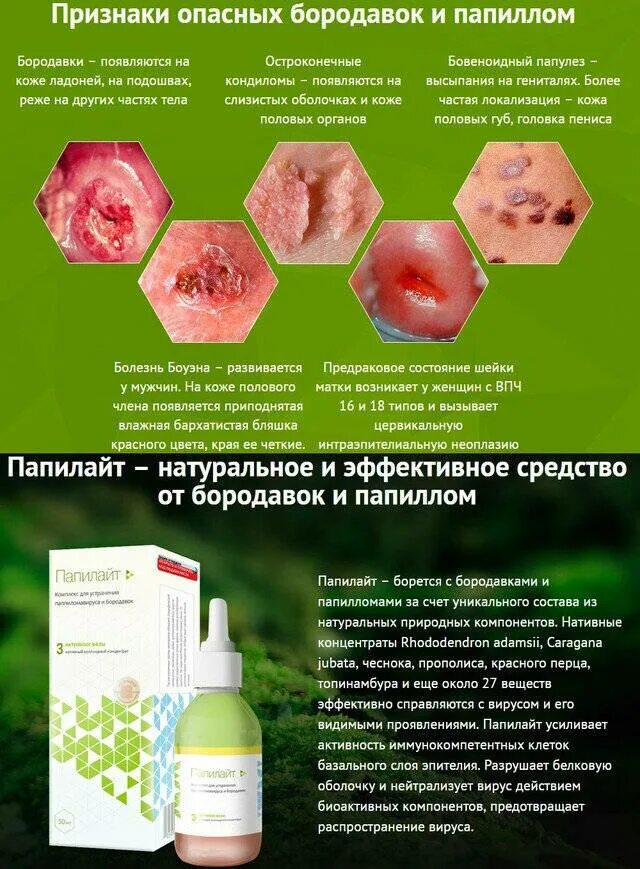 Как удалить бородавку народными средствами
