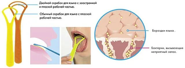 Рвотный рефлекс при чистке. Чистка языка зубной щеткой. Чистка языка от налета скребком.