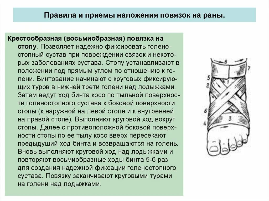 Техника наложения восьмиобразной повязки на голеностопный сустав. Восьмиобразная повязка техника наложения. Восьмиобразная повязка на голеностопный сустав алгоритм. Наложение крестообразной повязки на стопу.