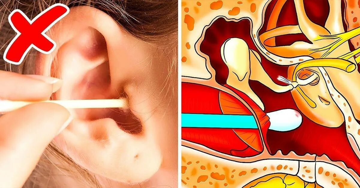 Почему одно ухо плохо. Дискомфорт в барабанных перепонках.