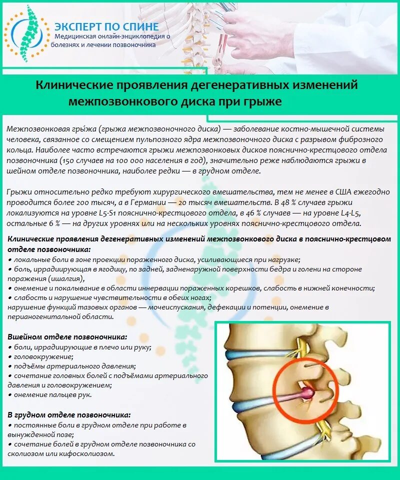 Неврологические симптомы грыжи межпозвоночной. Грыжа позвоночника поясничного отдела. Грыжи дисков шейного отдела позвоночника. Грыжа позвоночника поясничного отдела клинические рекомендации. Операции на поясничном отделе позвоночника отзывы