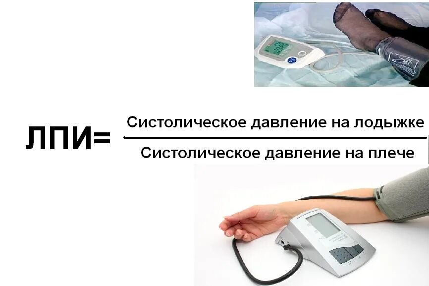 Скрининг артериального давления. Лодыжечно-плечевой индекс. измерение лодыжечно-плечевого индекса. измерение артериального давления на лодыжке. лпи систолического давления.