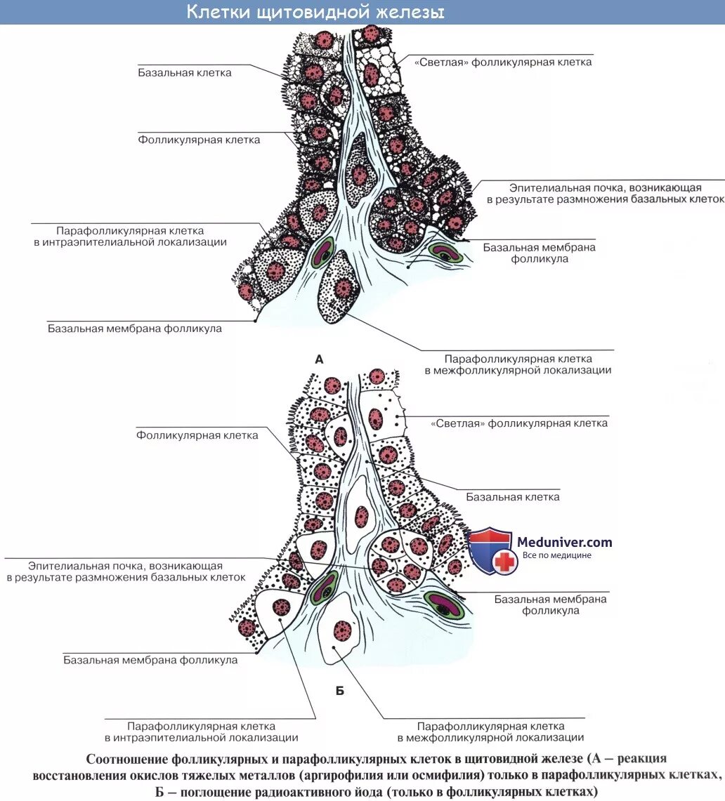 Срез щитовидной железы. Гиперфункция щитовидной железы гистология. Тироциты щитовидной железы гистология. Щитовидная железа гистология рисунок. Апудома щитовидной железы гистология.