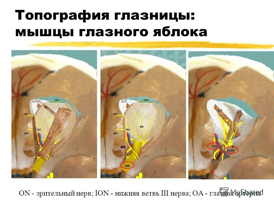 Глазных орбит и зрительных нервов. Топография органов глазницы. Мышцы глазницы анатомия нервы. Зрительный нерв в глазнице. Нервы выходящие из глазницы.