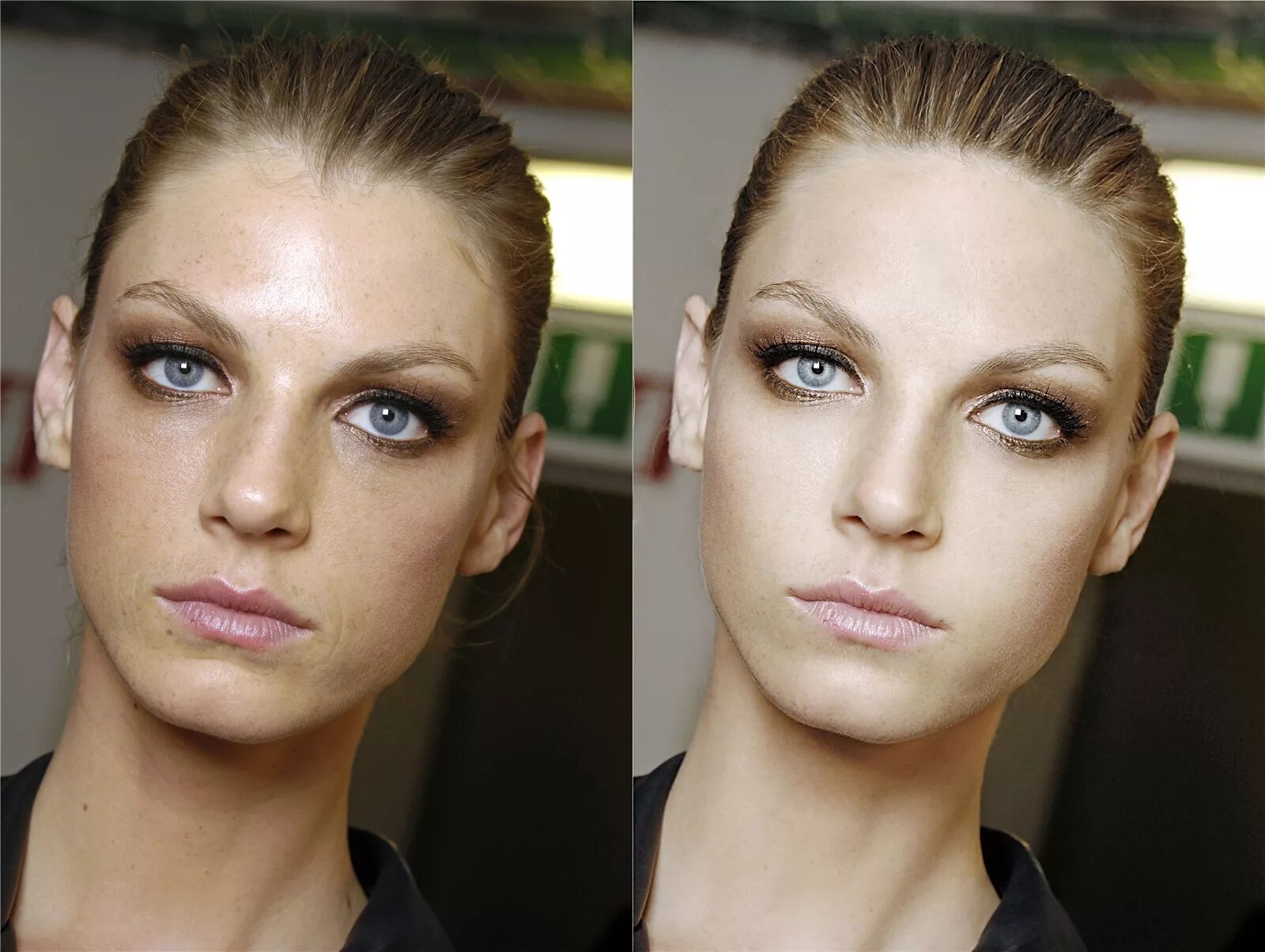 обработка кожи после