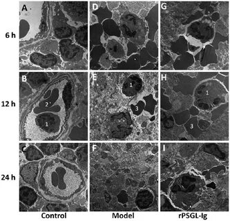 Transmission microscopy