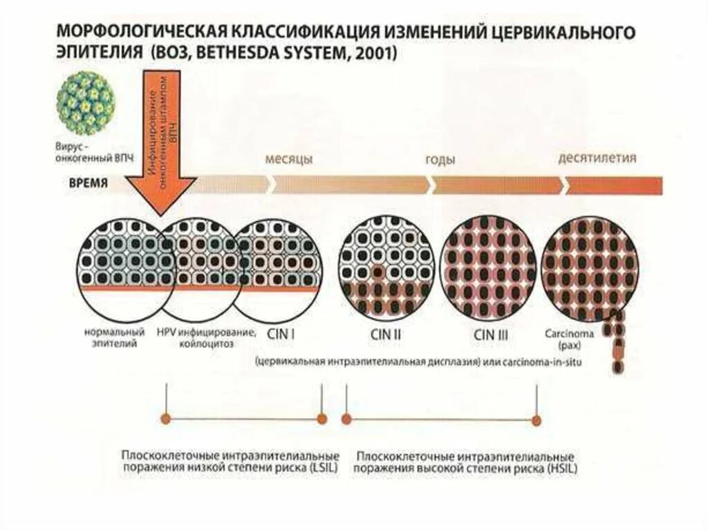 Плоское интраэпителиальное поражение низкой степени. Классификация дисплазии эпителия шейки матки. Морфологическая классификация эпителиев. Высокоонкогенные ВПЧ. Классификация цитологии шейки матки.