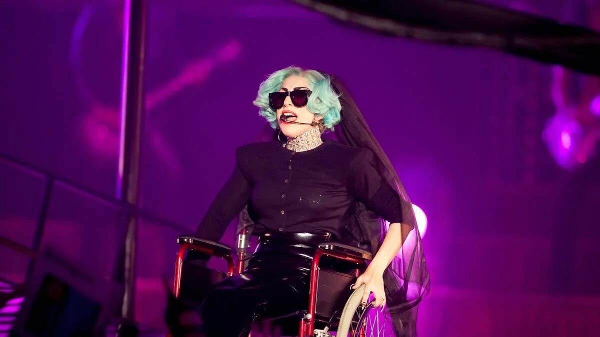 Леди гага фото толстая. Lady gaga "the fame monster". Lady gaga disease. Леди гага. Леди гага возраст.