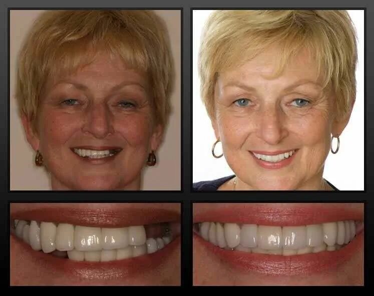 Smokers Teeth Bright Tooth Cleaning Liquid