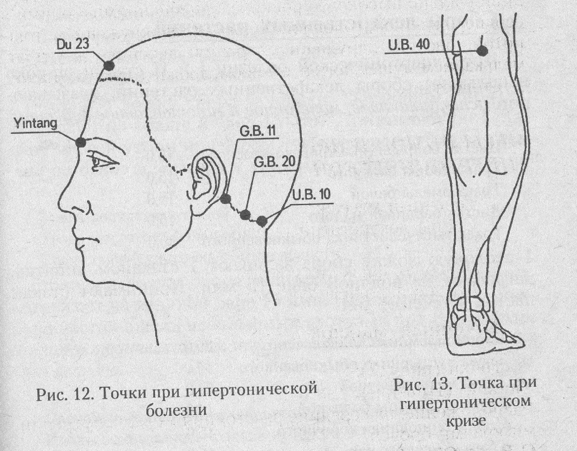 А 4 чтоб точка. Активные точки для снижения внутричерепного давления. Схема акупунктурных точек при гипертонии. Точечный массаж при внутричерепном давлении. Точки акупунктуры для снижения давления.