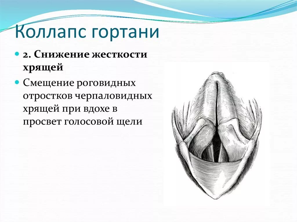 Голосовые связки у собаки анатомия. Голосовые связки анатомия. Удаление голосовых связок у собаки