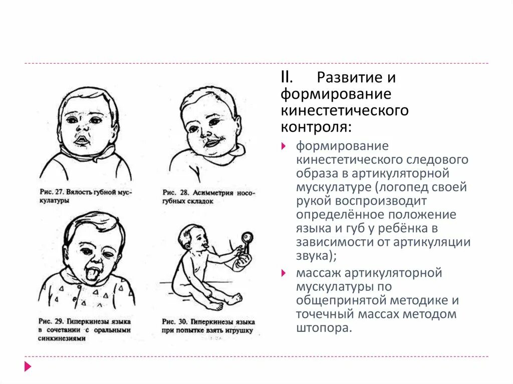 ДЦП симптомы у грудничков. ДЦП У детей симптомы в 1 год. Признаки ДЦП У грудничка. Признаки ДЦП У ребенка в 6 месяцев. У ребенка дцп форум