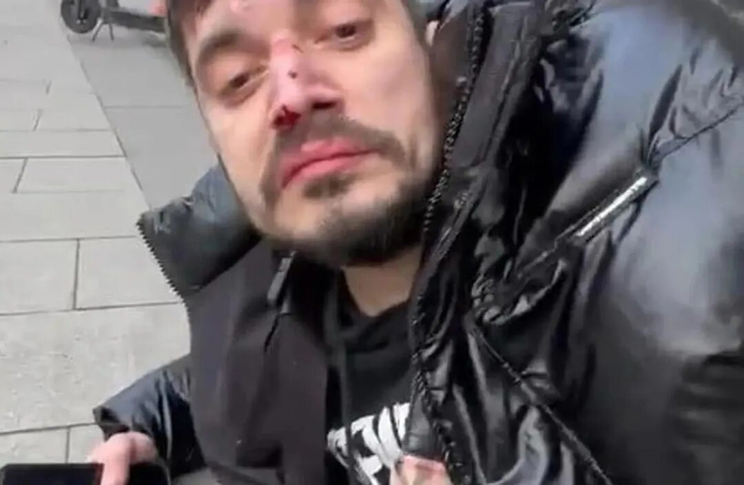 Первая кома паши техника