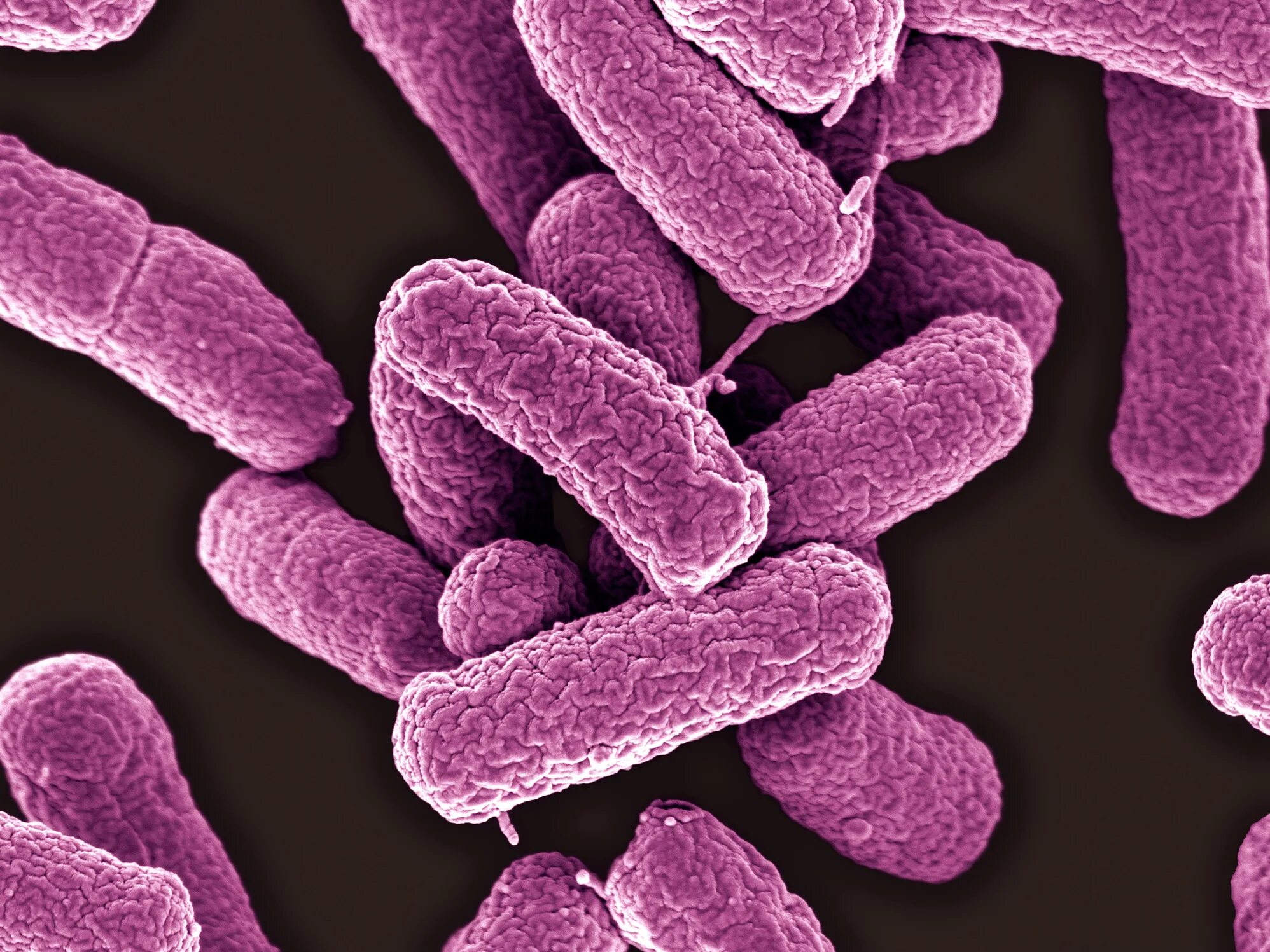 Бактерия Escherichia coli. О микроорганизмы Escherichia coli. Кишечная палочка e.coli. Кишечная палочка Еscherichia coli. Кишечная палочка половым