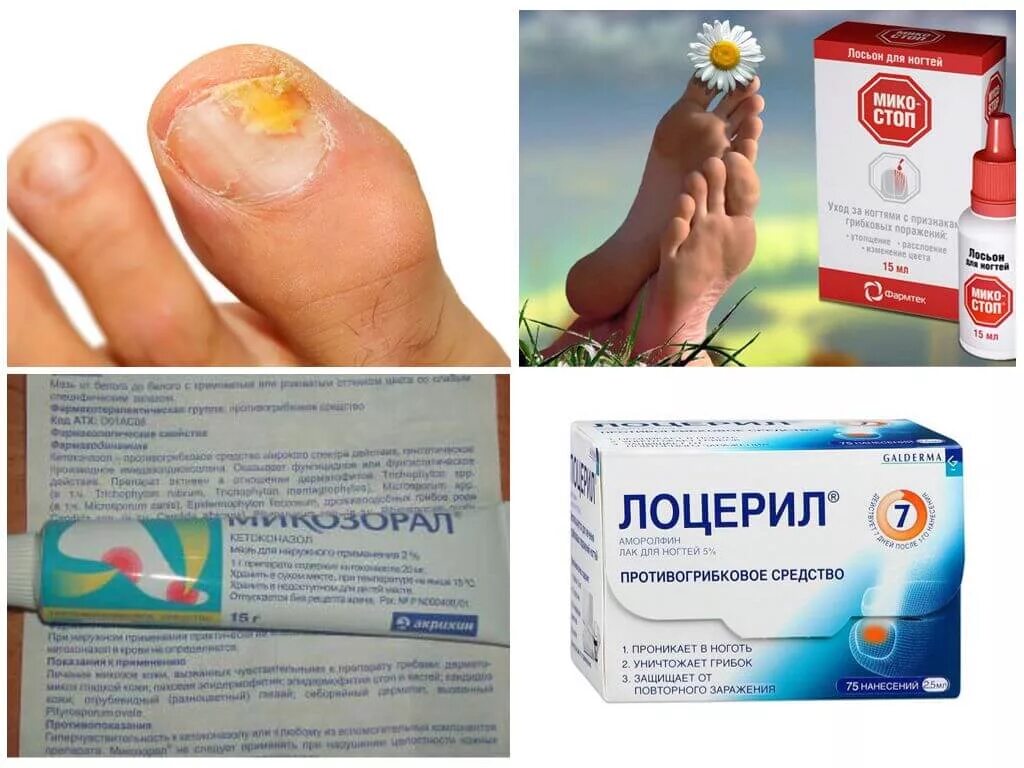 Athlete's Foot Treatment Associates in Medicine & Surgery