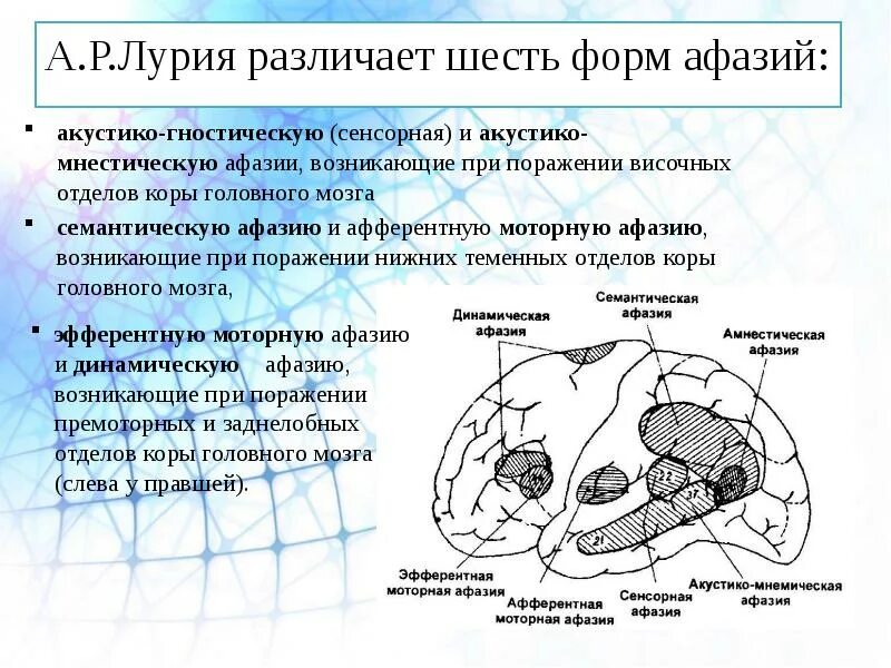 Недоразвитие зон мозга. Лурия задний отдел коры головного мозга. Афазия сенсорная моторная динамическая. Формы афазии по Лурия. Афазия мозг Лурия.