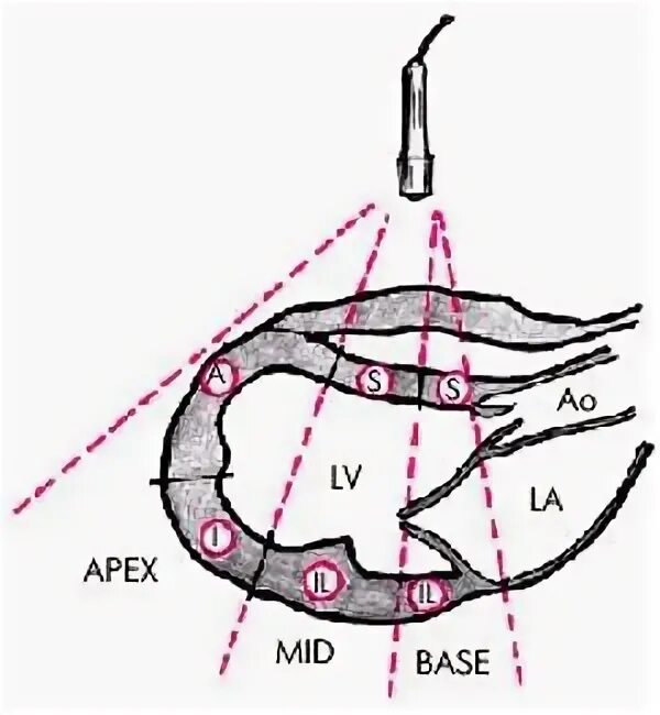 Сегменты левого желудочка ЭХОКГ схема. Сегменты миокарда левого желудочка. Сегменты левого желудочка схема. Сегменты миокарда левого желудочка схема.