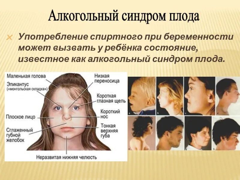 Синдромы подросткового возраста