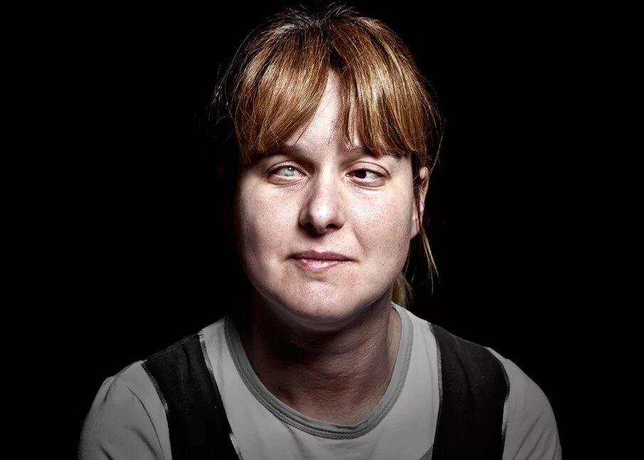 Как выглядят глаза слепого человека. Глаза слипова человека. Как выглядят глаза слепого человека. Взгляд слепого человека. Глаза слипова человека.